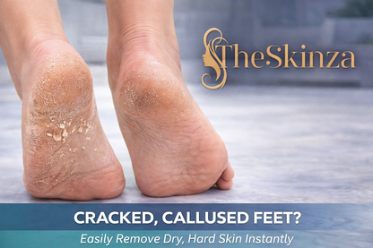 Foot Callus Remover Tool